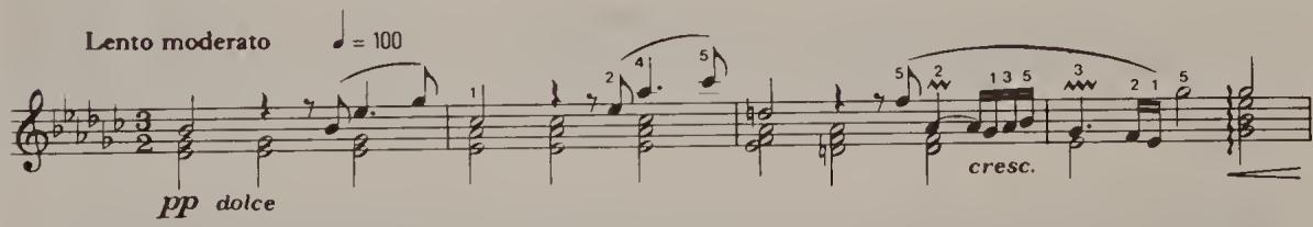 Ex. 10.1. Bars 1–4, ed. Czerny
