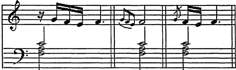 Example 5.10: Possible realizations of Sancta Maria&rsquo;s &ldquo;new and gallant&rdquo; quiebro for half-notes.；Only one ornament is given without notation by Sancta María, a type