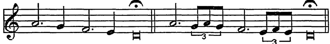 Example 5.15: Sancta Maria&rsquo;s two special cases concerning quarter-note quiebros.