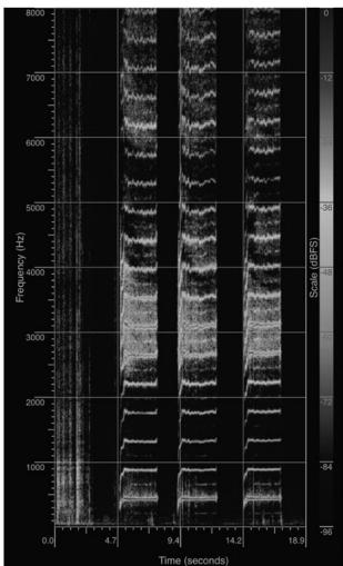 Fi 1 Spectrographic images of (a) breathy tone, (b) bel canto, and (c) belt. Images produced by Juanita Marchand Knight. Reproduced with permission.