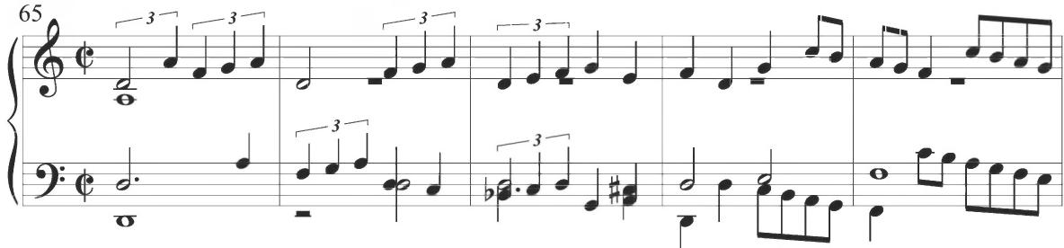 Cabezón, Diferencias sobre la Pavana Italiana, mm. 65-69；Brief passages of parallel thirds are included in the upper voices of Byrd&rsquo;s variation at measures 63, 65, and 69, with a style corresponding to Cabezón&rsquo;s frequently parallel technique, described in more detail above. Dotted figures are further incorporated within various contrapuntal voices through the variation in a pattern commonly consisting of a subsequent arching line, a stylistic characteristic also noted throughout many of Cabezón&rsquo;s earlier sets of variations. Additional